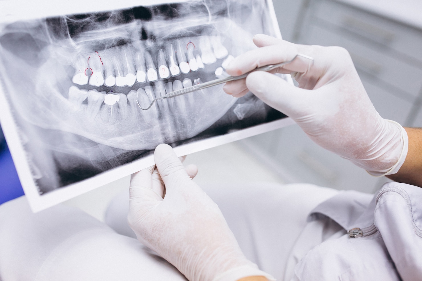 Radiologia Odontológica: entenda tudo sobre essa especialidade odontologica