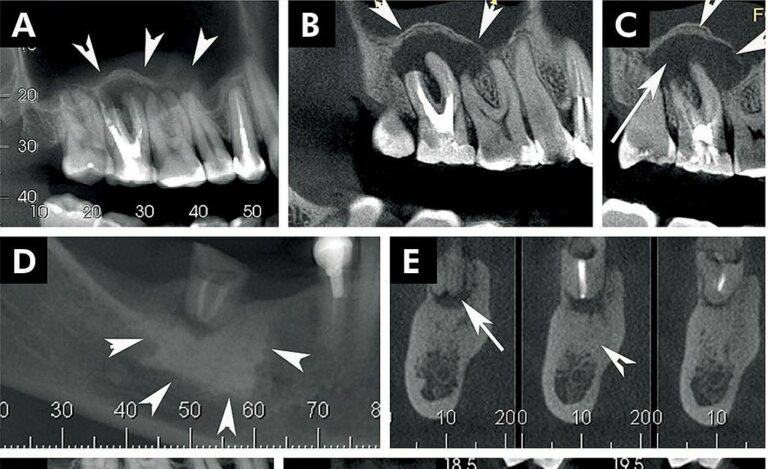 O que é tomografia do dente? Saiba tudo! | Dabi Atlante