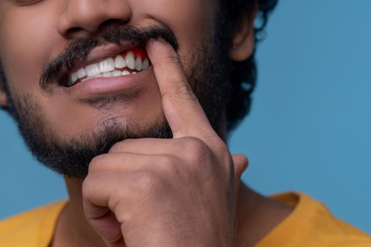 Doenças nos dentes: conheça as mais comuns e saiba como tratar