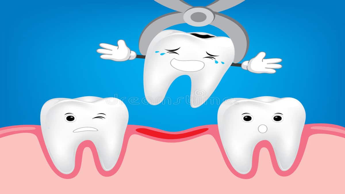 Extração de dente: saiba quando é realmente indispensável
