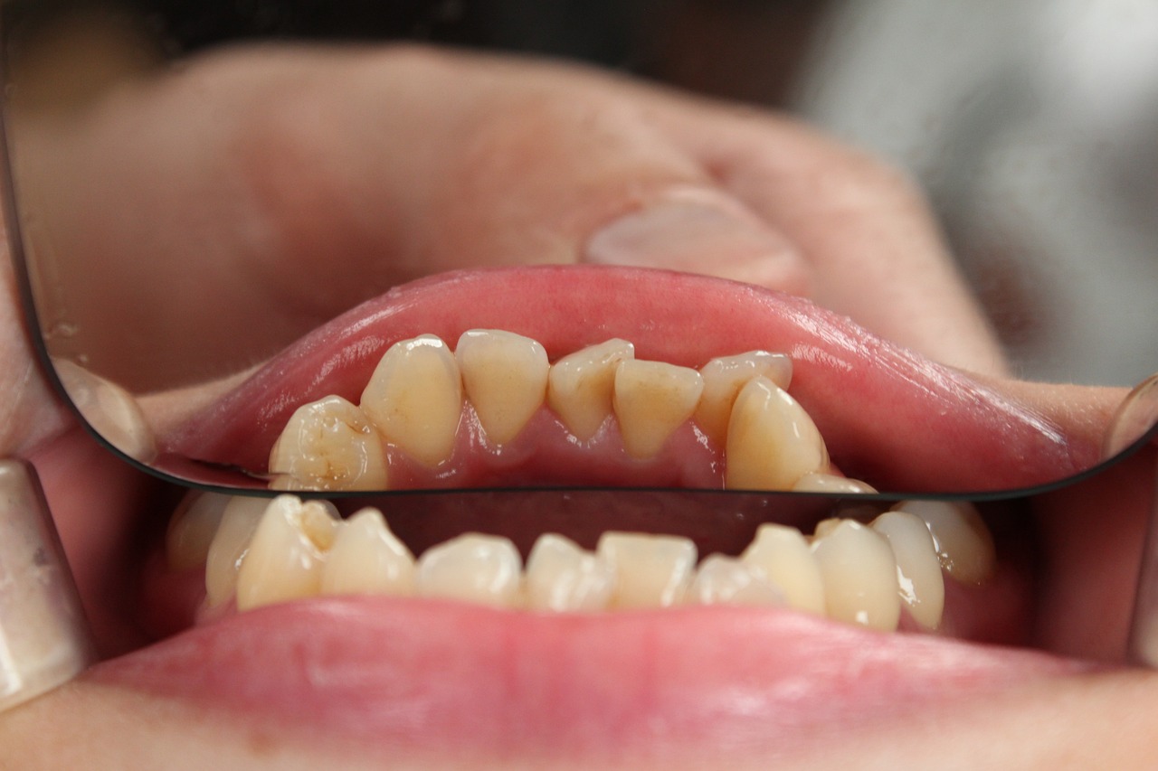 Ortodontia: veja como funciona essa especialidade