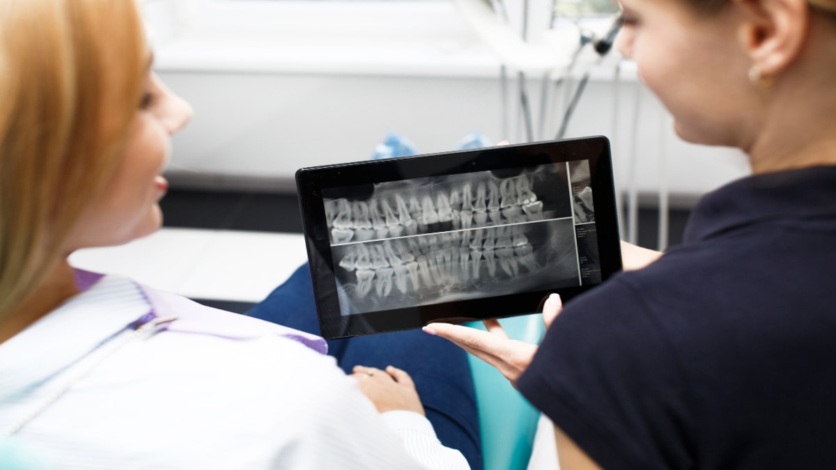 Radiografia Dentária: tire todas as suas dúvidas de 2 formas