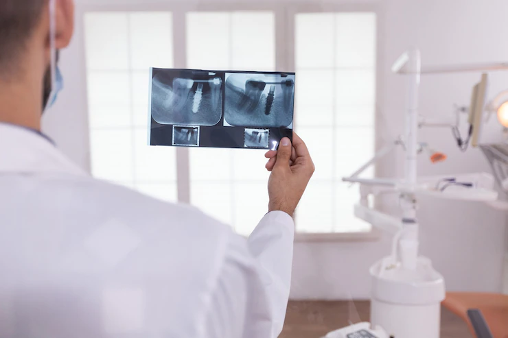 Radiografía periapical: qué es y cómo funciona este tipo de procedimiento