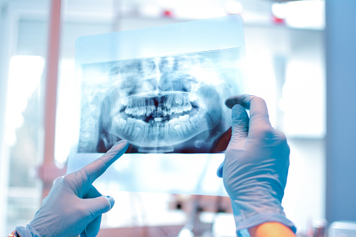 Radiografias dos dentes: veja todos os tipos que existem na odontologia