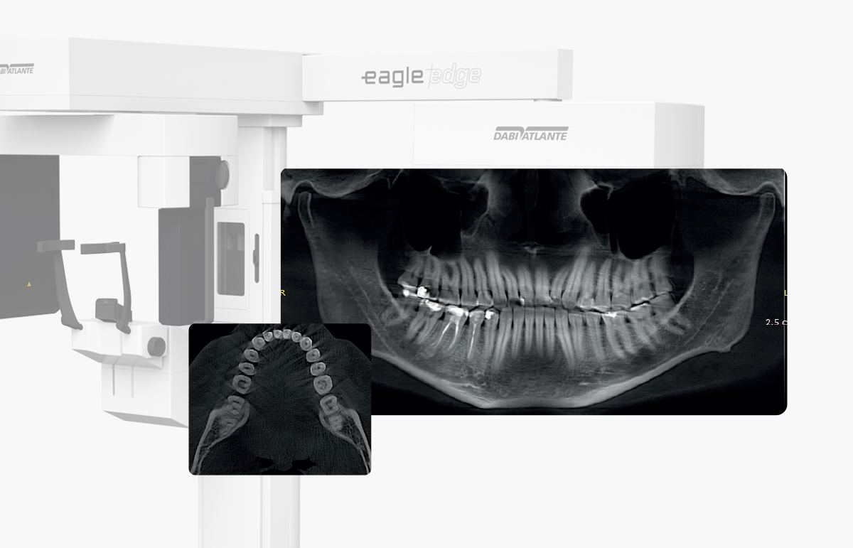 Eagle Edge 2D (línea PRO): La innovación de la Panorámica Multislice para diagnóstico dental avanzado