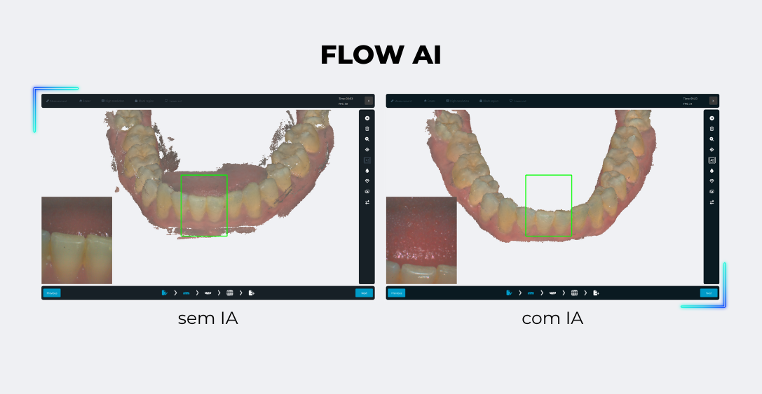 Eagle Scan esc&aacute;ner intraoral Flow AI escaneo arco completo 59 segundos dental