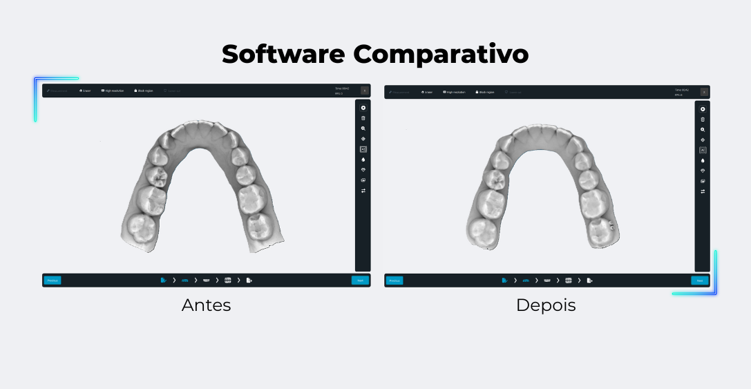Eagle Scan esc&aacute;ner intraoral software Eagle Eye mapa de calidad oclusi&oacute;n